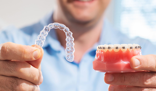 Dentist holding clear aligner and dental model demonstrating orthodontic treatment options.